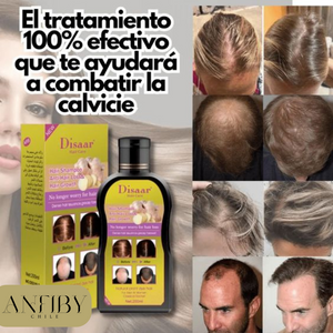 Shampoo Anti Caída DISAAR 200ml 🌿💧